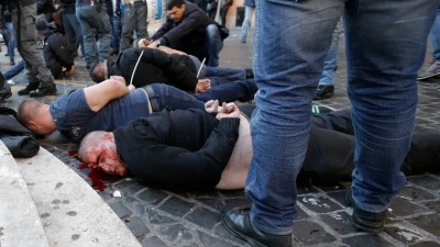 Χάος στα Τίρανα: Βίαιες συγκρούσεις μεταξύ αστυνομικών και Ιταλών, Ολλανδών οπαδών - Δεκάδες απελάσεις και συλλήψεις