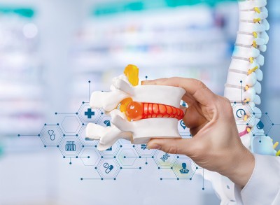 Δέκα μύθοι και δέκα αλήθειες για τη δισκοκήλη