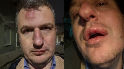 Βόλος: Άγρια επίθεση στον εκδότη της εφημερίδας «Μαγνησία» έξω από το σπίτι του