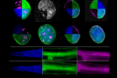 Μοριακό μηχανισμό των κυττάρων που ρυθμίζει τη γήρανση ανακάλυψαν Έλληνες επιστήμονες - Συμμετείχε η κόρη του Παπανδρέου