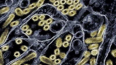 ΗΠΑ: Δεύτερος θάνατος λόγω της γρίπης των πτηνών - Ηλικιωμένος με πτηνοτροφείο στον κήπο του