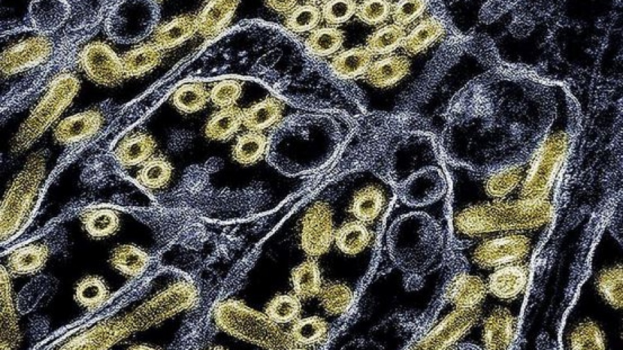 ΗΠΑ: Δεύτερος θάνατος λόγω της γρίπης των πτηνών - Ηλικιωμένος με πτηνοτροφείο στον κήπο του