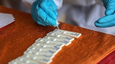 ΕΟΔΥ: 6 θάνατοι από covid-19, 8 διασωληνωμένοι 158 εισαγωγές - Ένα σοβαρό κρούσμα γρίπης