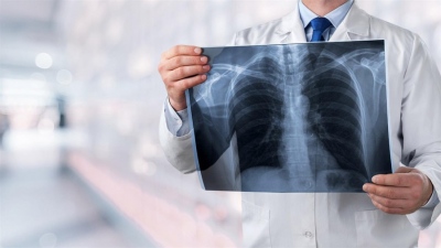 Παγκόσμια ημέρα Ακτινολογίας 2025 - Από την πλευρά της Παιδοακτινολόγου