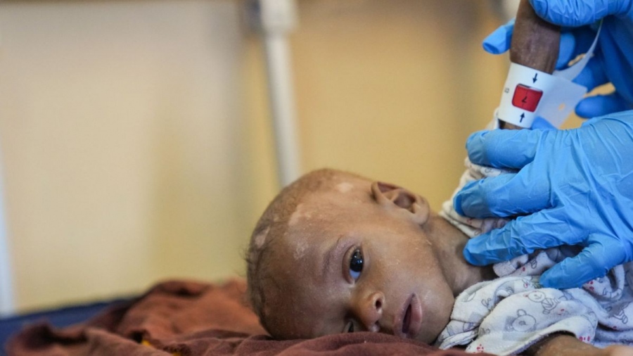 ΟΗΕ: Τουλάχιστον 21.000 παιδιά έχουν καταστεί ανάπηρα από την έναρξη του πολέμου Ισραήλ - Hamas στη Γάζα