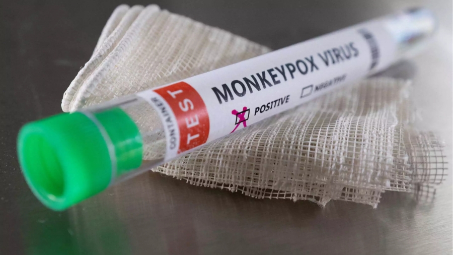 Ευλογιά των πιθήκων - Σε 69 έφτασαν τα κρούσματα στην Ελλάδα