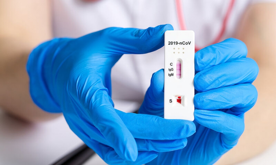 Με θετικό rapid test οι αναρρωτικές άδειες- Τι ισχύει για τα πιστοποιητικά νόσησης