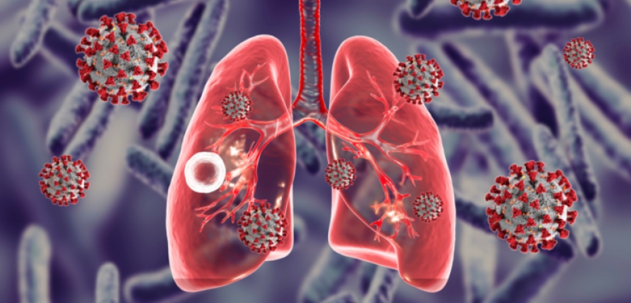 Αυξήθηκαν οι θάνατοι από φυματίωση λόγω Covid-19 - Για παράπλευρες απώλειες κάνει λόγο ο ΠΟΥ
