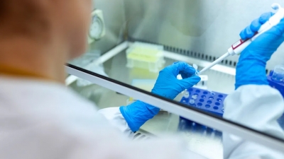 Κορωνοϊός - Στα 43.914 κρούσματα την τελευταία εβδομάδα (21-27/11) - 118 θάνατοι, 93 διασωληνωμένοι