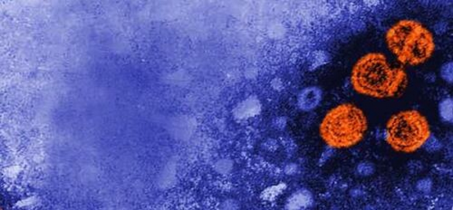 Κάτι περίεργο συμβαίνει: Δεκάδες περιπτώσεις μυστηριωδών κρουσμάτων ηπατίτιδας σε Ευρώπη, ΗΠΑ