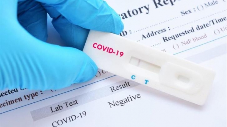 Αντιδράσεις από τα διαγνωστικά κέντρα για το rapid test: «Ανέφικτο να πραγματοποιηθεί η εξέταση στην τιμή των 10 ευρώ»