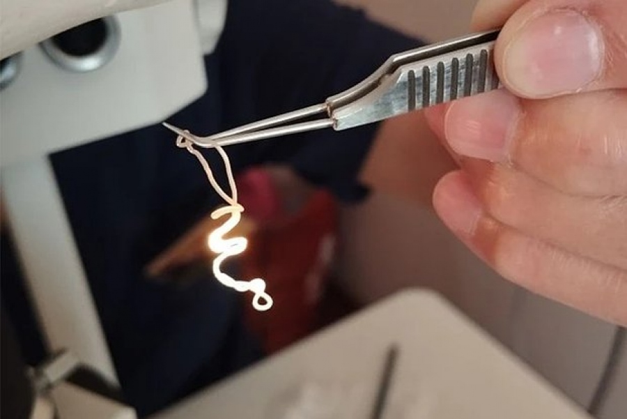 Ένα ζωντανό σκουλήκι 20 εκατοστών αφαιρέθηκε από το μάτι ενός άνδρα