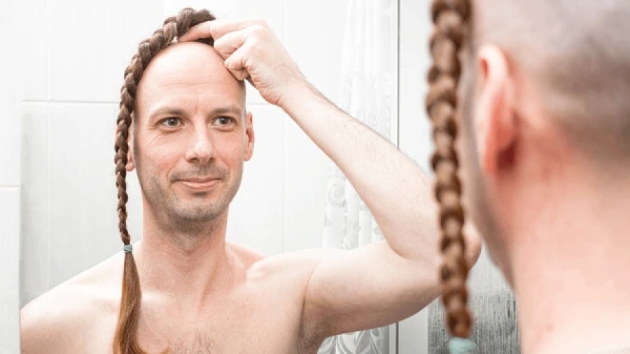 Άνδρες προσοχή: Αυτά τα ποτά προκαλούν τη μεγαλύτερη τριχόπτωση - Σταματήστε τα... χθες!