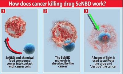 Σκωτία: Έρευνα βρήκε μόριο που λειτουργεί ως «Δούρειος Ίππος» και σκοτώνει τα καρκινικά κύτταρα