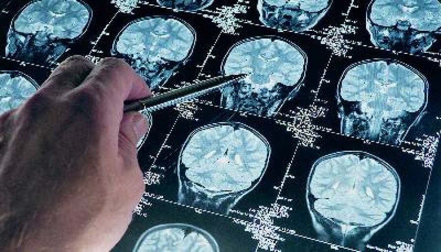 Γράφεται ιστορία... πολύ κοντά στο φάρμακο για τον αλκοολισμό η επιστήμη