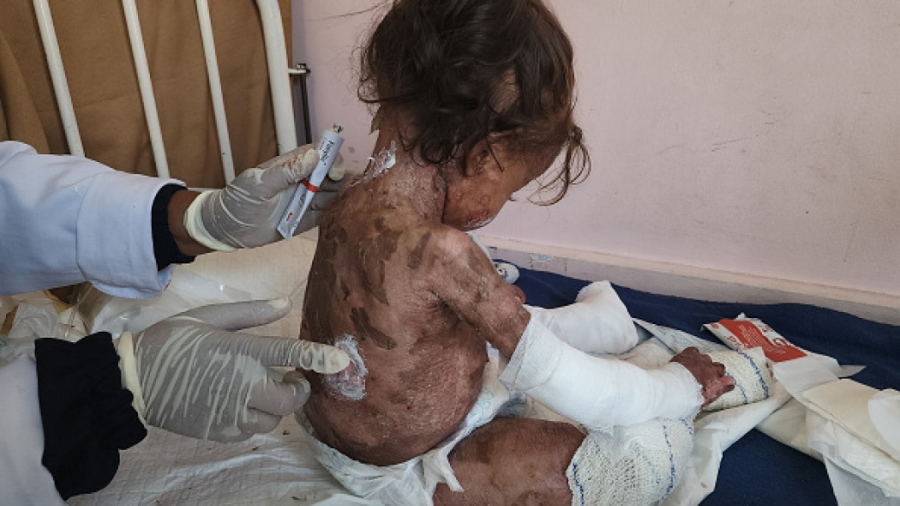 Σαρώνουν τα μωρά οι αρρώστιες - Η κατεστραμμένη Γάζα αντιμετωπίζει τρομερή αύξηση σπάνιων παιδικών λοιμώξεων