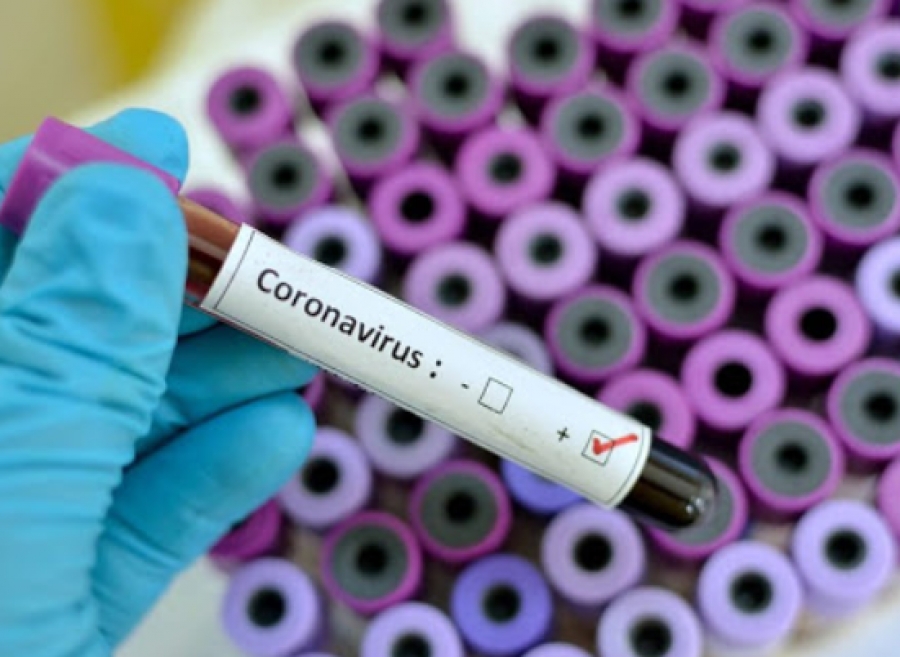 Πανεπιστήμιο Οξφόρδης : Σε παιδιά το εμβόλιο της AstraZeneca κατά της covid-19