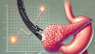 Νοσοκομείο «Μεταξά»: Πραγματοποιήθηκε με επιτυχία η πρώτη βιοψία παγκρέατος με ενδοσκοπικό υπέρηχο