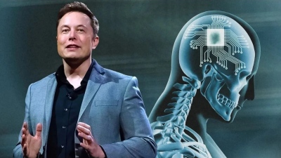 Ο Elon Musk ξεκινά δοκιμές σε ανθρώπους για εμφύτευση τσιπ στον εγκέφαλο - Μόνον για... δισεκατομμυριούχους