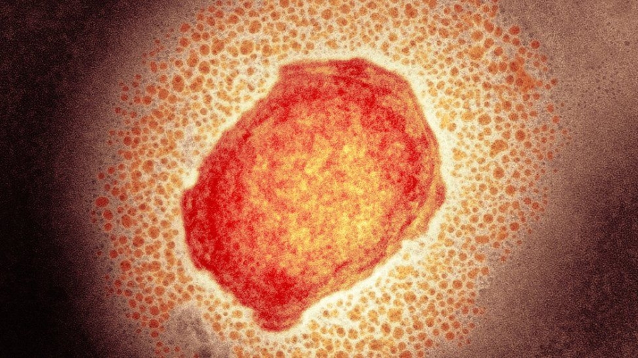 Όλα όσα θέλετε να μάθετε για την ευλογιά των πιθήκων ή Monkeypox – Ο ιός μπορεί να εξελιχθεί σε πανδημία;