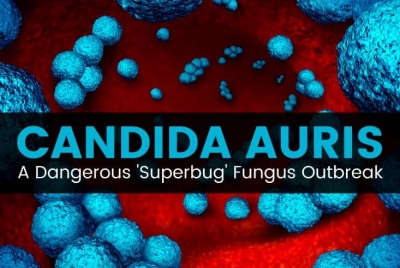 Συναγερμός ΕΟΔΥ για τον θανατηφόρο ιό Candida auris: Διαδέχεται τον κορωνοϊό με θνητότητα - σοκ 60% - Αποκάλυψη Σύψα