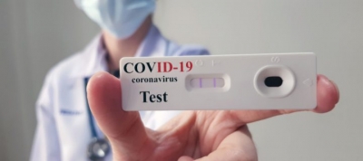 Ακριβαίνουν κατά 6% self test, rapid test και PCR για τον covid – H εγκύκλιος της ΑΑΔΕ για τις νέες τιμές