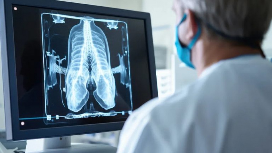 Πνευμονία: Τι είναι, πως να την αντιμετωπίσουμε και πως να την προλάβουμε