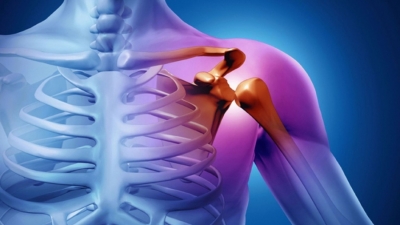Ρήξη τένοντα ώμου: Πως να απαλλαγείτε οριστικά από τον πόνο