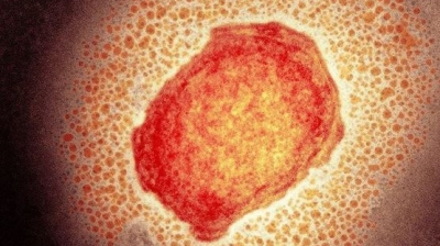 Ευλογιά των πιθήκων: Πόσο μεγάλη θα είναι η διασπορά του ιού - Η προέλευση, τα μέτρα προστασίας και η θεραπεία
